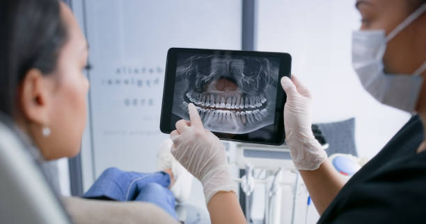 Best Chipped Tooth Repair Near Me  in Fillmore, CA